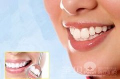 圣贝特惠  1元体验美齿