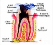 看得准才能做得精 显微根管治疗课堂开讲